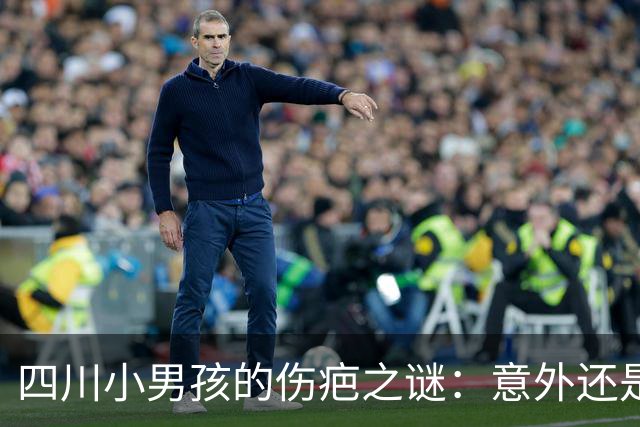 四川小男孩的伤疤之谜：意外还是虐待？